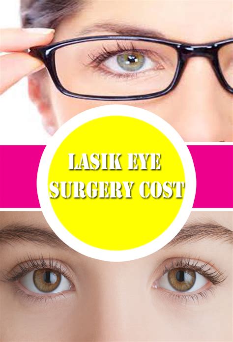 cheap lasik eye surgery in bay area